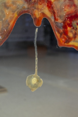 Lukas Malte Hoffmann