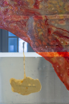 Lukas Malte Hoffmann